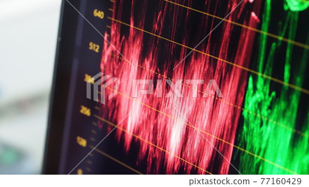 Color grading indicator graph on screen. RGB colour correction graphic bar on monitor in post production process. Telecine stage in video or film production processing. for colorist digital grading. 77160429