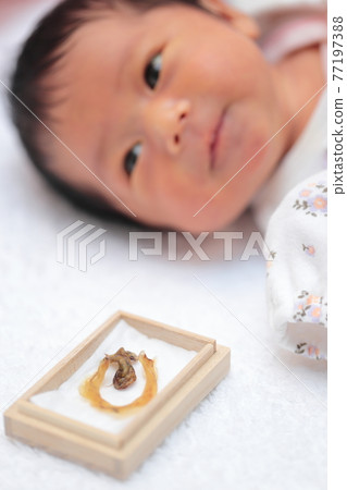 Newborn girl with umbilical cord removed 77197388