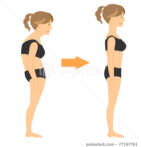Posture correction before and after Posture correction before and after 77197761