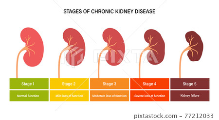 Kidney disease concept Kidney disease concept 77212033