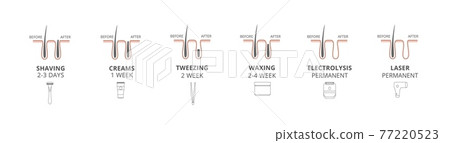 Hair removal methods - laser and shaving, creams and tweezing, waxing and electrolysis. Procedure of beauty before and after effects for skin body. Set of vector illustrations. 77220523