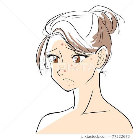 Woman with acne Woman with acne 77222673