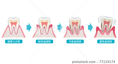 牙周病醫療的進展 77229174