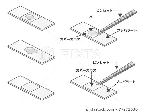 Illustration of preparation and tweezers 4 Illustration of preparation and tweezers 4 77272536