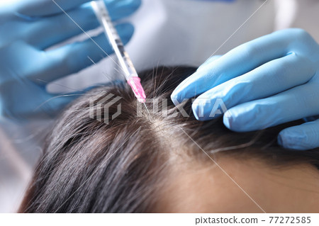 Trichologist makes an injection into scalp closeup 77272585
