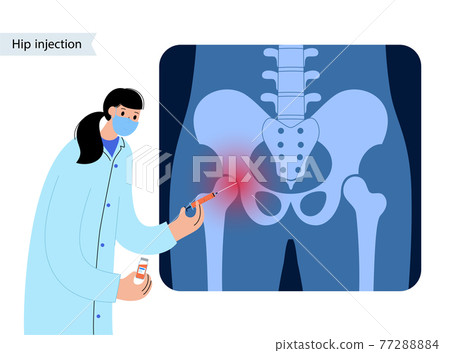 Hip joint injection Hip joint injection 77288884