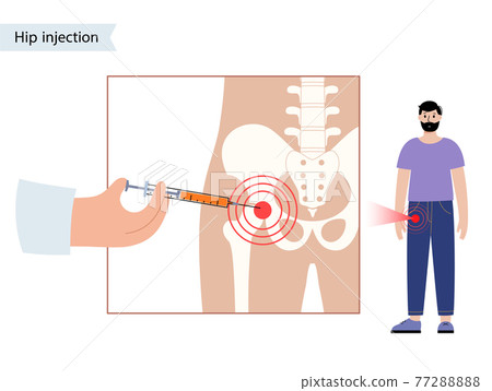 Hip joint injection Hip joint injection 77288888