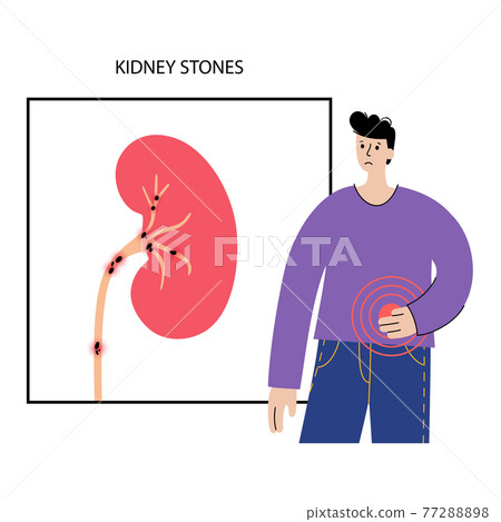 Kidney disease concept 77288898