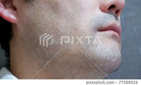 Middle-aged man's beard Middle-aged man's beard 77308528