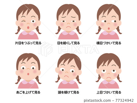 Illustration Of A Child's Amblyopia Check - Stock Illustration 