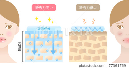 Cross-sectional view of women with high-penetration skin and low-penetration skin 77361769