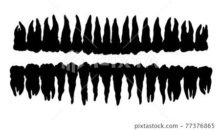 The layout of the teeth. Vector drawing 77376865