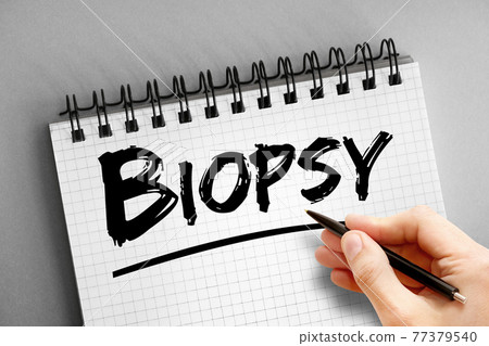 Biopsy text on notepad, concept background 77379540