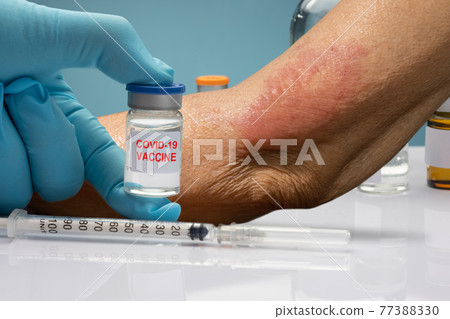 vaccine covid 19 allergies symptom in elderly after vaccination. vaccine covid 19 allergies symptom in elderly after vaccination. 77388330