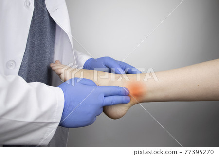 The podiatrist examines the heel and its ridges in a patient who complains of acute pain. Suspected plantar fasciitis, achillodynia, or heel spur. The podiatrist examines the heel and its ridges in a patient who complains of acute pain. Suspected plantar fasciitis, achillodynia, or heel spur. 77395270