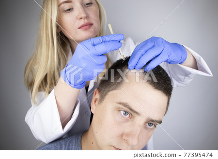 A trichologist doctor drips the serum onto the patient's hair. Treatment of alopecia. Hair loss, alopecia, pruritus, burning head or seborrhea 77395474