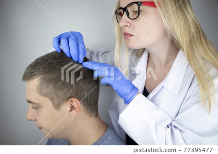 A trichologist examines the hair of a man who begins alopecia. Consultation with a dermatologist. Hair loss, alopecia, pruritus, burning head or seborrhea 77395477
