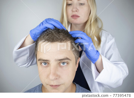 A trichologist examines the hair of a man who begins alopecia. Consultation with a dermatologist. Hair loss, alopecia, pruritus, burning head or seborrhea 77395478