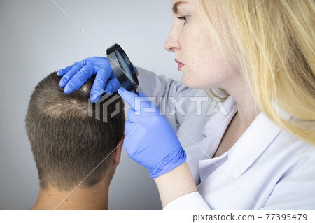 A trichologist examines the hair of a man who begins alopecia. Consultation with a dermatologist. Hair loss, alopecia, pruritus, burning head or seborrhea 77395479