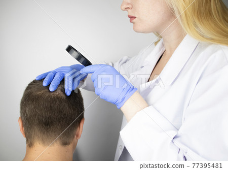 A trichologist examines the hair of a man who begins alopecia. Consultation with a dermatologist. Hair loss, alopecia, pruritus, burning head or seborrhea 77395481