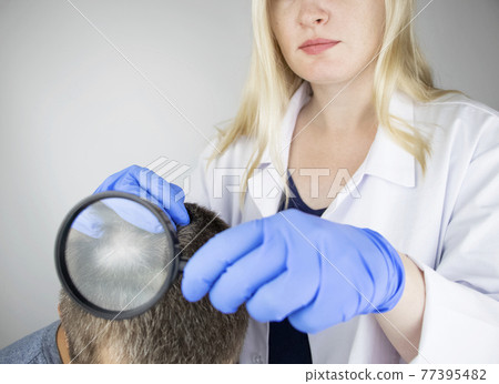 A trichologist examines the hair of a man who begins alopecia. Consultation with a dermatologist. Hair loss, alopecia, pruritus, burning head or seborrhea 77395482