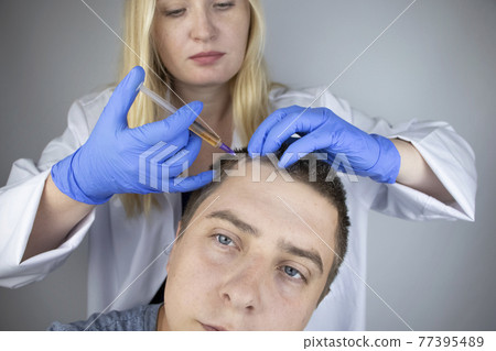 The doctor trichologist conducts mesotherapy or plasma therapy. Treatment of alopecia. Hair loss, alopecia, pruritus, burning head or seborrhea 77395489