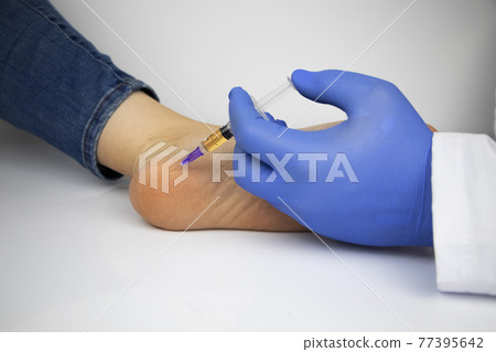 An orthopedic surgeon gives an injection in the heel to relieve pain from a heel spur. The concept of medical care and non-surgical treatments. An orthopedic surgeon gives an injection in the heel to relieve pain from a heel spur. The concept of medical care and non-surgical treatments. 77395642