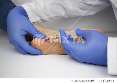 An orthopedic surgeon gives an injection in the heel to relieve pain from a heel spur. The concept of medical care and non-surgical treatments. An orthopedic surgeon gives an injection in the heel to relieve pain from a heel spur. The concept of medical care and non-surgical treatments. 77395644