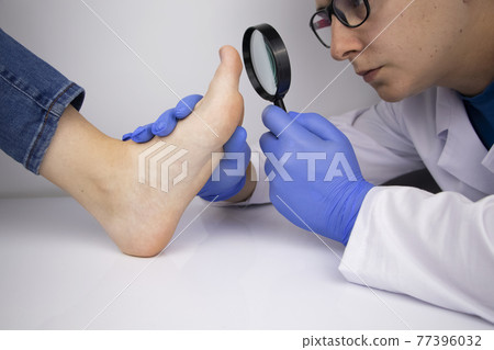A trichologist examines a toenail with a magnifying glass, which is affected by the fungus. Treatment of mycosis and assistance to patients with fungal diseases. A trichologist examines a toenail with a magnifying glass, which is affected by the fungus. Treatment of mycosis and assistance to patients with fungal diseases. 77396032