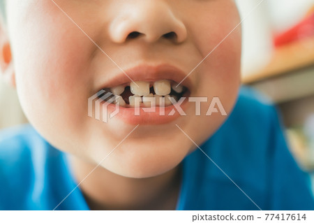 younger, baby boy, boy 77417614