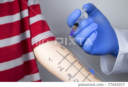 An allergist doctor makes a skin test for allergies. The boy is being examined in the laboratory, waiting for a reaction to allergens. An allergist doctor makes a skin test for allergies. The boy is being examined in the laboratory, waiting for a reaction to allergens. 77483057
