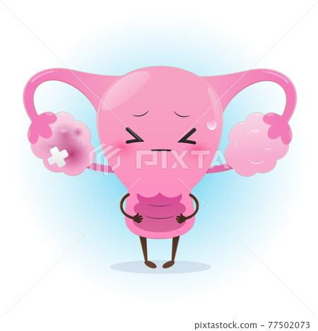 Illustration uterus & inflamed ovary 77502073