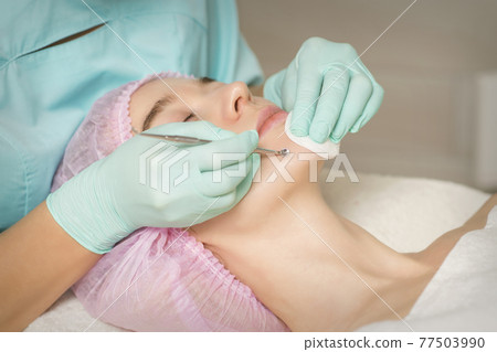 Beautician removing blackhead and acne Beautician removing blackhead and acne 77503990
