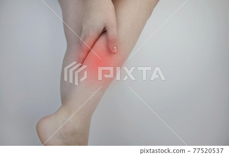 A woman suffers from pain in the calves. Stretching the calf muscle, varicose veins, leg cramps, or myositis. Orthopedic doctor examines patient 77520537