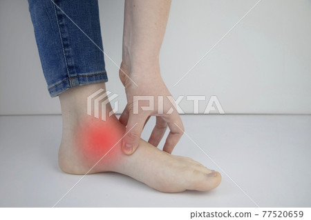 Woman suffering from heel pain. Inflammation or sprain of the tendon in the foot, heel spur, bursitis. The concept of diseases and pains in the leg 77520659