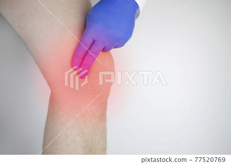 A man suffers from knee pain. Examination by an orthopedist and traumatologist. Redness and swelling of the legs, torn meniscus or knee bursitis 77520769