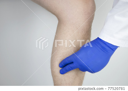 A man suffers from pain in the calves. Stretching the calf muscle, varicose veins, leg cramps, or myositis. Orthopedic doctor examines 77520781