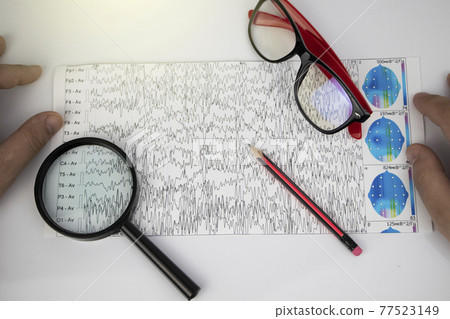 A neurologist examines an encephalogram of a patient brain. Schedule of electroencephalograms - study of brain currents for signs of epilepsy and pathologies of the nervous system A neurologist examines an encephalogram of a patient brain. Schedule of electroencephalograms - study of brain currents for signs of epilepsy and pathologies of the nervous system 77523149
