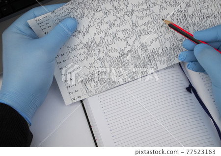 A neurologist examines an encephalogram of a patient brain. Schedule of electroencephalograms - study of brain currents for signs of epilepsy and pathologies of the nervous system A neurologist examines an encephalogram of a patient brain. Schedule of electroencephalograms - study of brain currents for signs of epilepsy and pathologies of the nervous system 77523163
