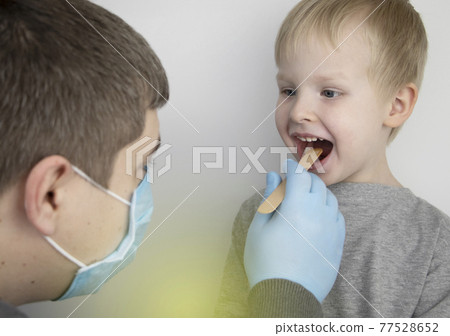 An otolaryngologist examines a child's throat with a wooden spatula. A possible diagnosis is inflammation of the pharynx, tonsils or pharyngitis. The concept of treatment and prevention of childhood An otolaryngologist examines a child's throat with a wooden spatula. A possible diagnosis is inflammation of the pharynx, tonsils or pharyngitis. The concept of treatment and prevention of childhood 77528652