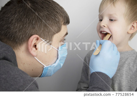 An otolaryngologist examines a child's throat with a wooden spatula. A possible diagnosis is inflammation of the pharynx, tonsils or pharyngitis. The concept of treatment and prevention of childhood 77528654