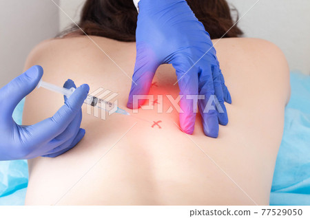 Cerebrospinal injection with ozone to relieve pain and inflammation in the back. Treatment of osteochondrosis and arthrosis of the spine with blockade therapy Cerebrospinal injection with ozone to relieve pain and inflammation in the back. Treatment of osteochondrosis and arthrosis of the spine with blockade therapy 77529050