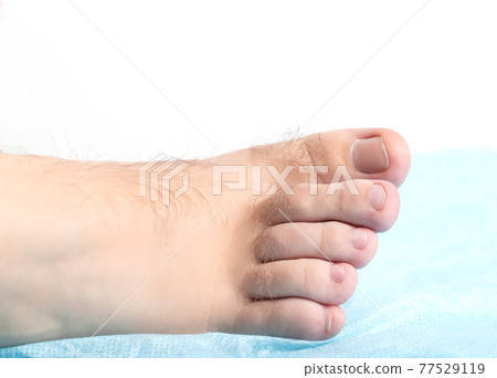Human toe hair. Leg hair removal concept. Copy space for text Human toe hair. Leg hair removal concept. Copy space for text 77529119