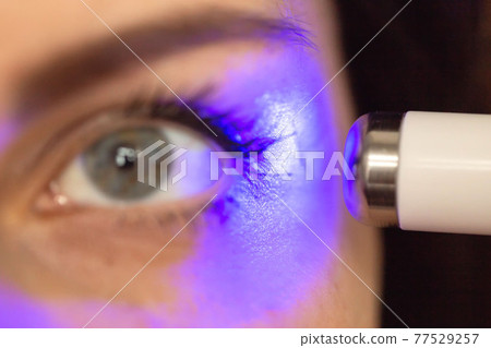 Professional removal of skin scars using laser resurfacing. Beautiful girl performs a procedure to remove a scar near the eye, macro Professional removal of skin scars using laser resurfacing. Beautiful girl performs a procedure to remove a scar near the eye, macro 77529257