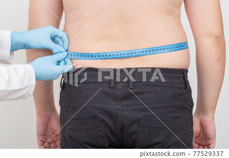 Doctor nutritionist measures the big fat belly of a male patient with a measuring tape. Weight loss and healthy lifestyle concept, excess weight 77529337
