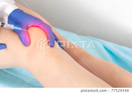 The doctor makes a puncture with intra-articular injection of drugs into the patient's knee joint. Injection of medication into a sore knee, treatment 77529348
