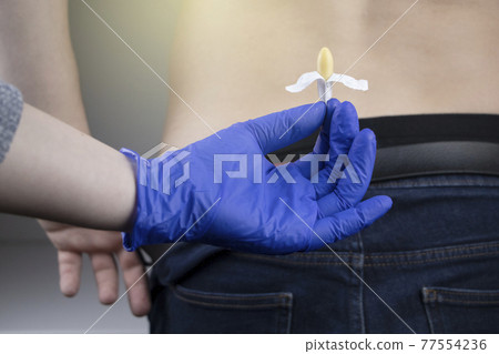 A man at a proctologist's appointment. The doctor holds a rectal suppository before entering the anus. Hemorrhoids or prostate treatment concept. 77554236