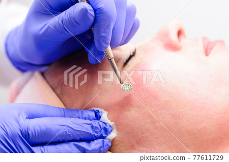 Mechanical cleansing of the face with a spoon uno, removing grease and blackheads. Mechanical cleansing of the face with a spoon uno, removing grease and blackheads. 77611729