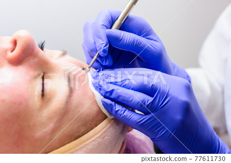 Mechanical facial cleansing, skin cleansing procedure from surface and deep impurities. 77611730