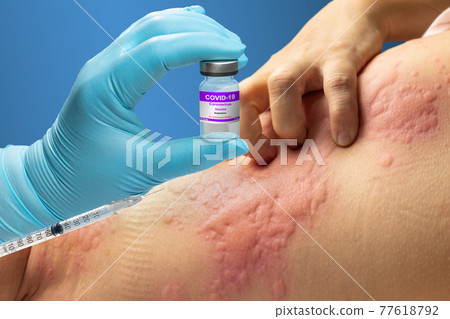 vaccine covid 19 allergies symptom in elderly after vaccination. vaccine covid 19 allergies symptom in elderly after vaccination. 77618792
